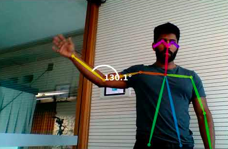 Coviu's PhysioRom is an effective diagnostic tool that can be used during video consultations.