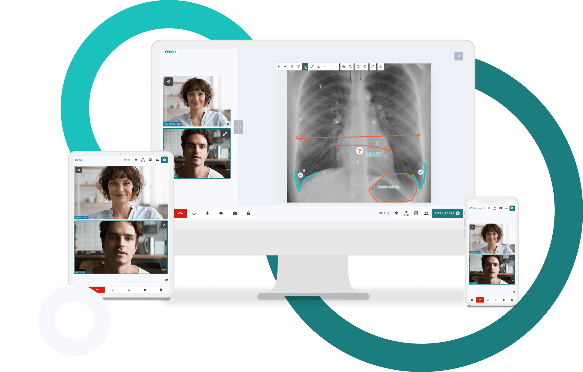 XRAY - Multiple Devices - 3 Circles