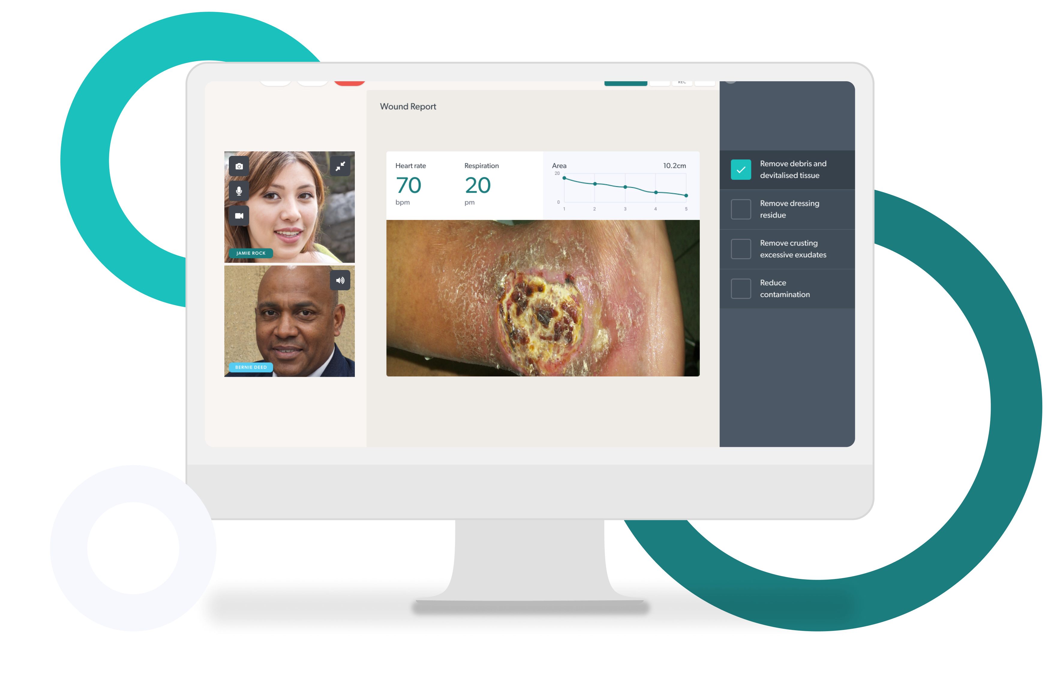 Coviu leads creation of AI digital tool-kit to transform wound care