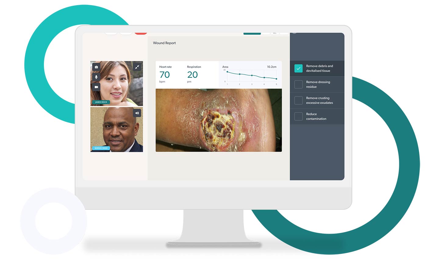 Coviu leads creation of AI digital tool-kit to transform wound care